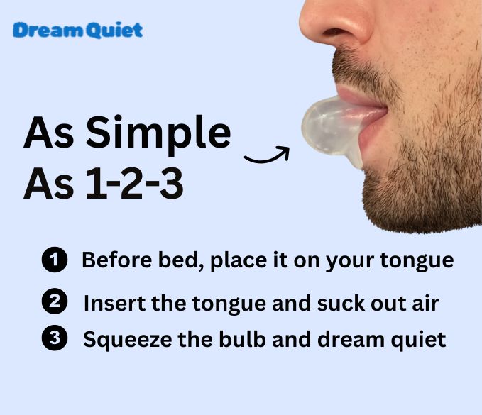 DreamQuiet™ Anti-Snoring Mouthpiece