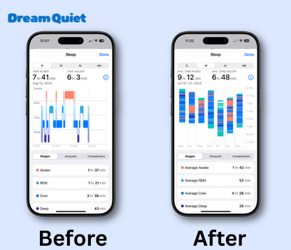 DreamQuiet™ Anti-Snoring Mouthpiece